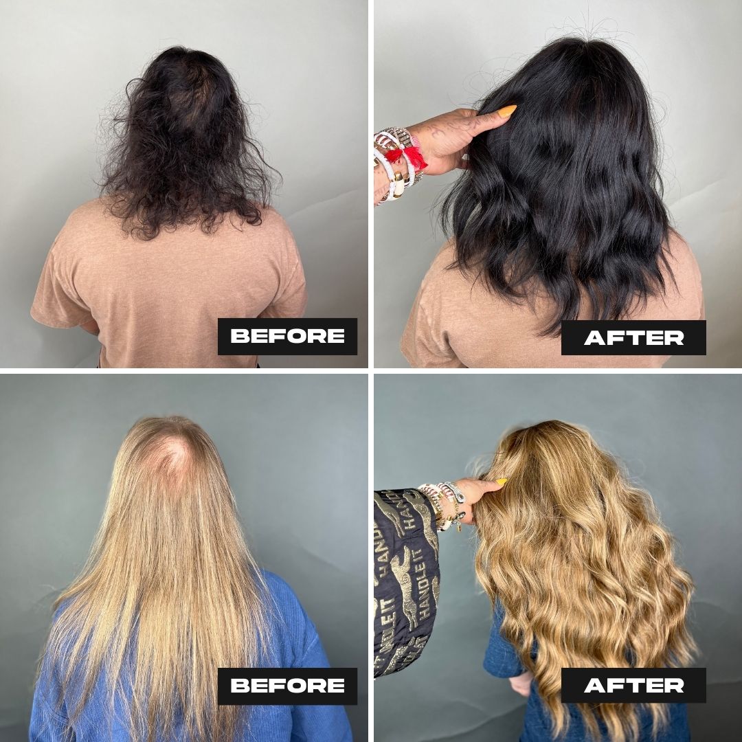 Before and after, Can Extensions Cover Bald Spots? Exploring Solutions