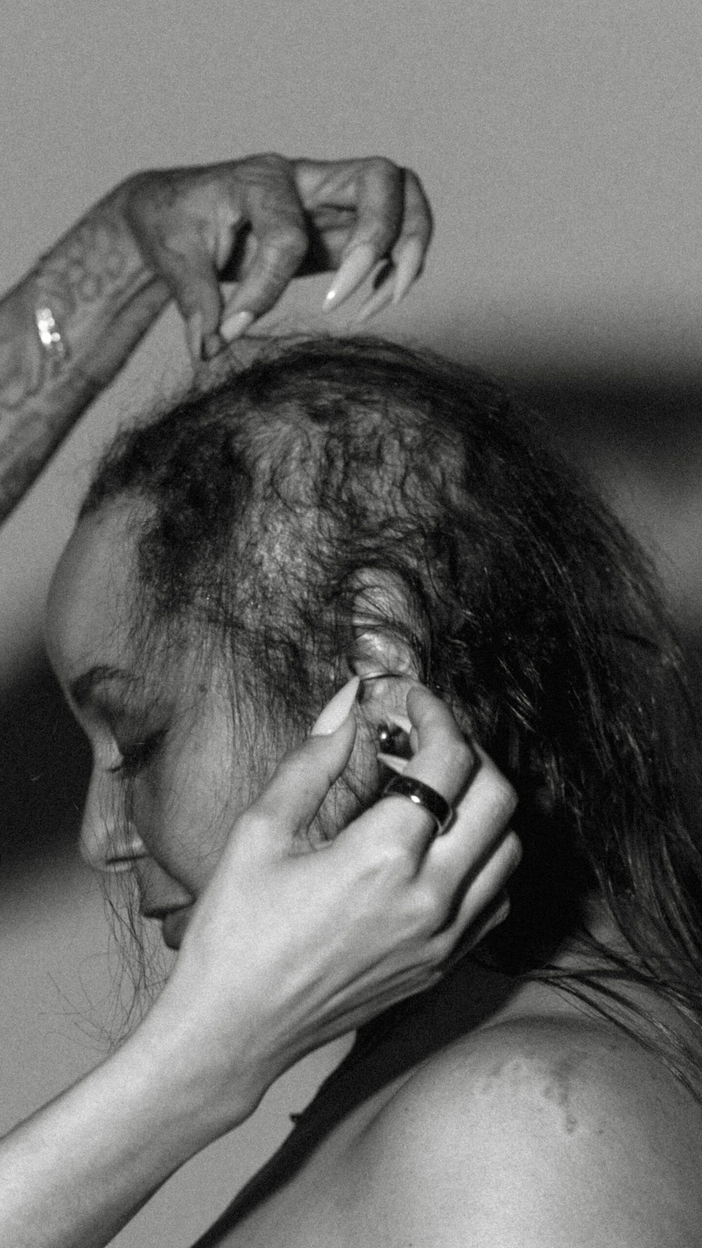 a stylist gently lifts thinning strands of hair, showing hair loss in women